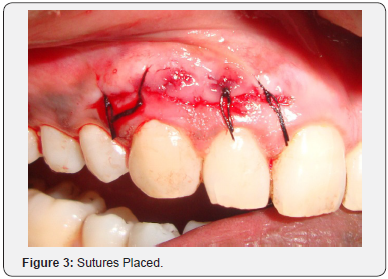 Click here to view Large Figure 3