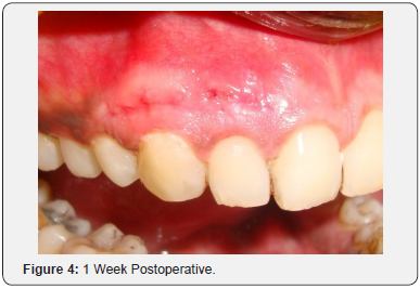 Click here to view Large Figure 4