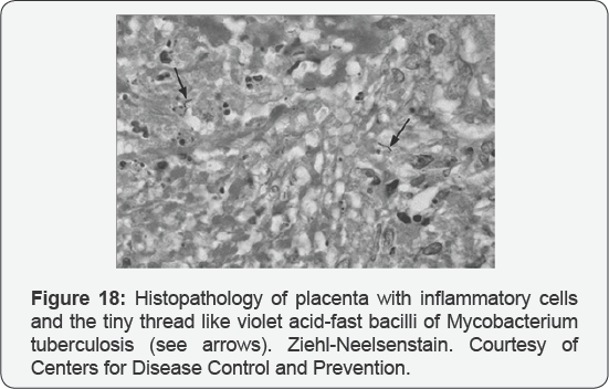 Click here to view Large Figure 18