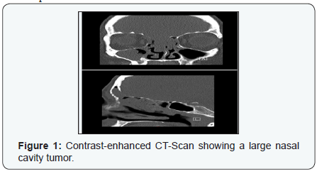 Click here to view Large Figure 1