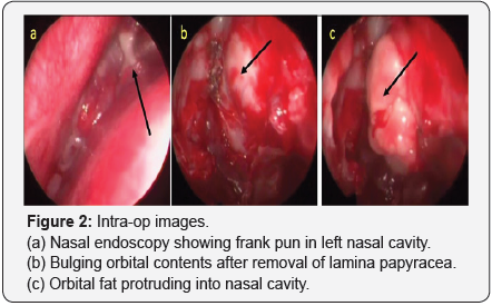 Click here to view Large Figure 2
