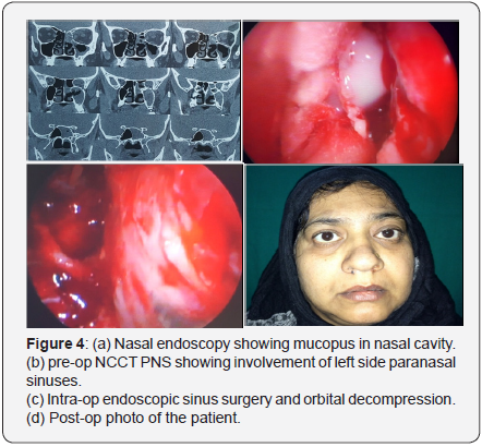 Click here to view Large Figure 4