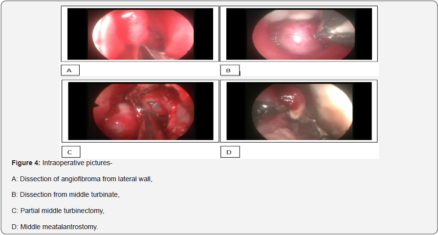 Click here to view Large Figure 4