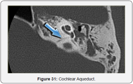 Click here to view Large Figure 32