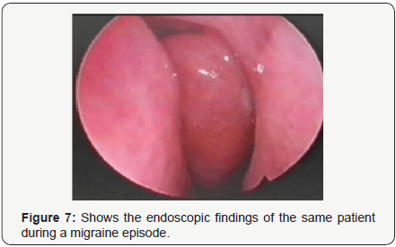 Click here to view Large Figure 7