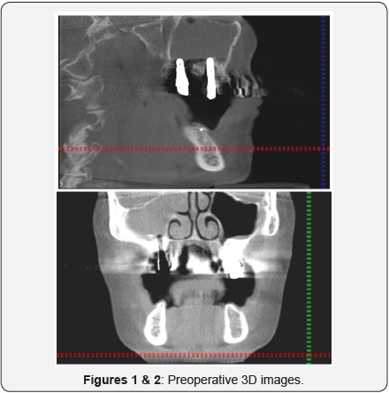 Click here to view Large Figure 1&2