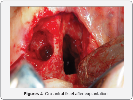 Click here to view Large Figure 3