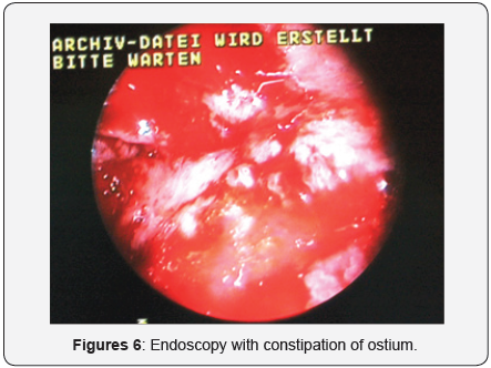 Click here to view Large Figure 5