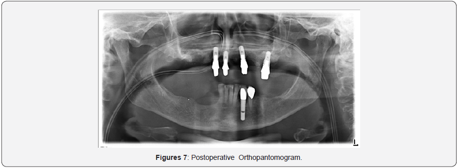 Click here to view Large Figure 6