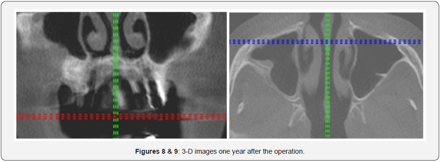 Click here to view Large Figure 7