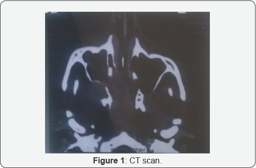 Click here to view Large Figure 1
