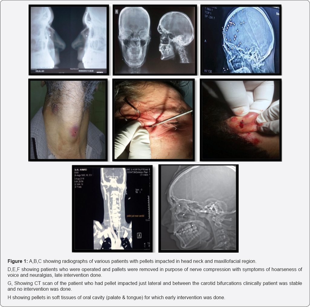 Click here to view Large Figure 1