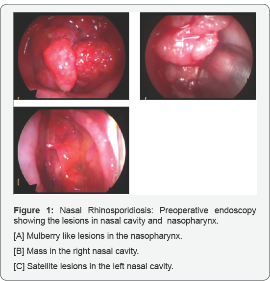 Click here to view Large Figure 1