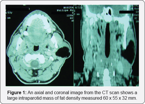 Click here to view Large Figure 1