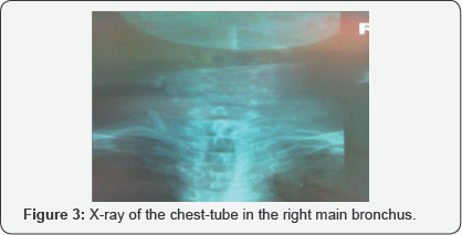 Click here to view Large Table 1