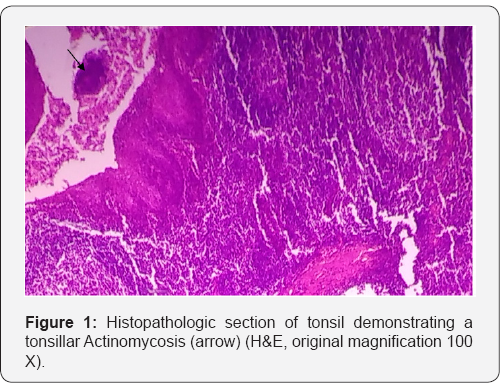Click here to view Large Figure 1