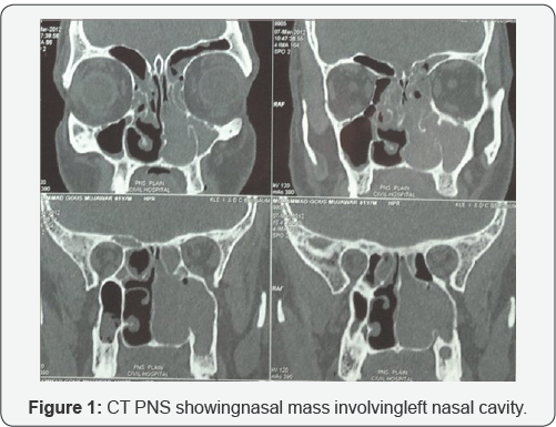 Click here to view Large Figure 1