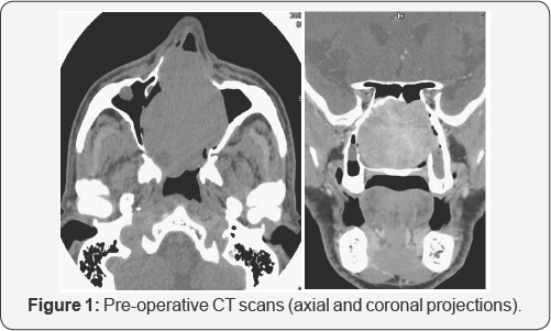 Click here to view Large Figure 1