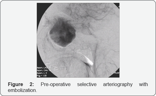 Click here to view Large Figure 2
