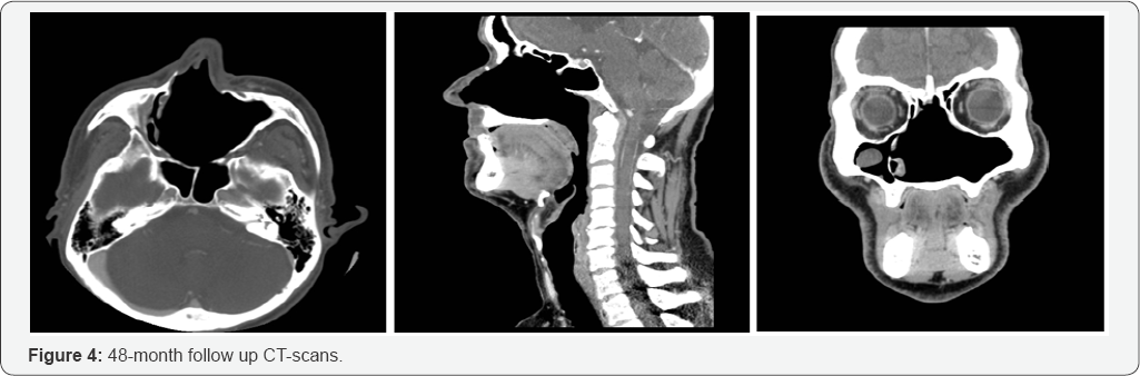 Click here to view Large Figure 4