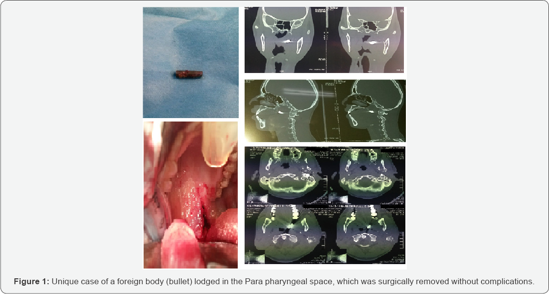 Click here to view Large Table 1