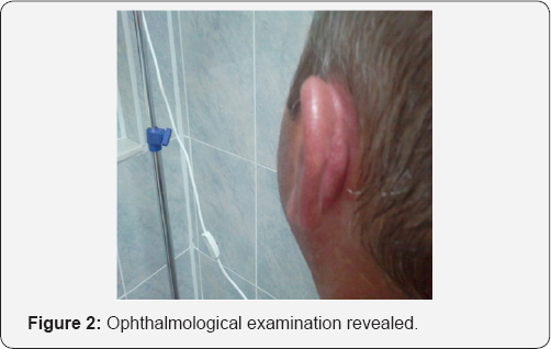 Click here to view Large Figure 2