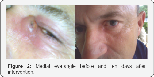 Click here to view Large Figure 2