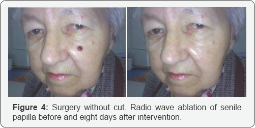 Click here to view Large Figure 4