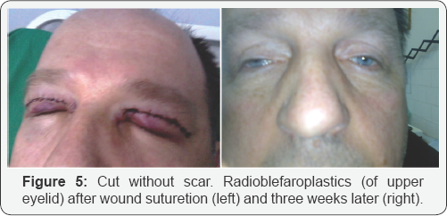 Click here to view Large Figure 5