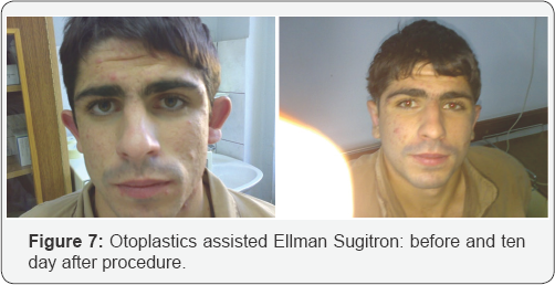 Click here to view Large Figure 7