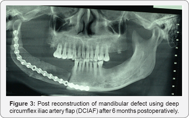 Click here to view Large Figure 3