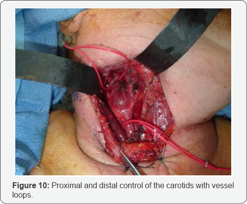 Click here to view Large Figure 9