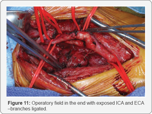 Click here to view Large Figure 11