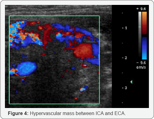 Click here to view Large Figure 4