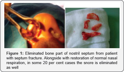 Click here to view Large Figure 1