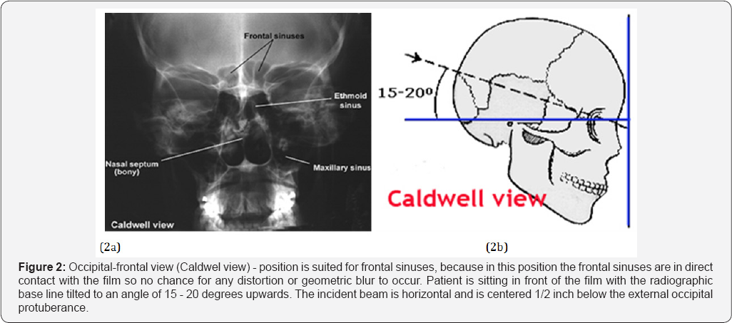 Click here to view Large Figure 2