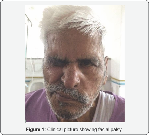 Click here to view Large Figure 1