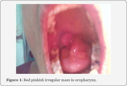 Click here to view Large Figure 1