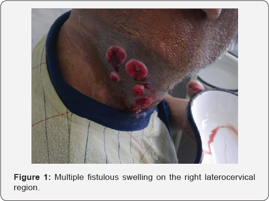 Click here to view Large Table 1