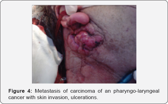 Click here to view Large Table 1