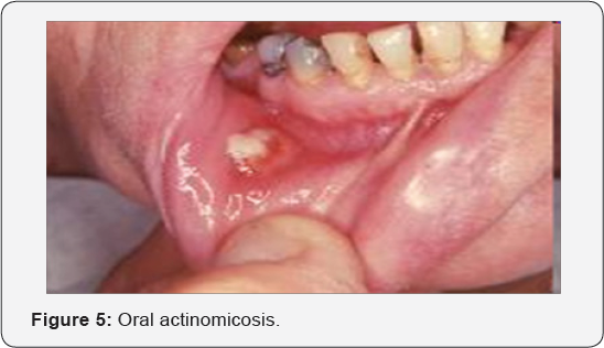 Click here to view Large Table 1