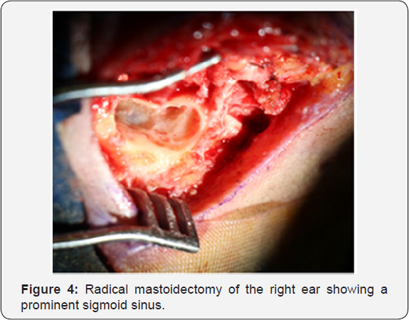 Click here to view Large Figure 4