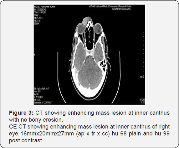 Click here to view Large Table 1