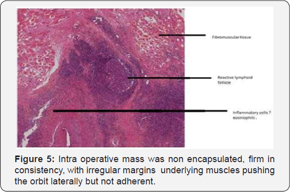 Click here to view Large Table 1