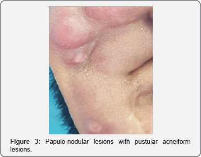 Click here to view Large Figure 3