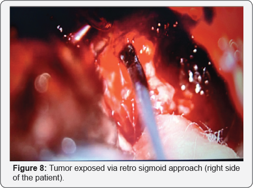 Click here to view Large Table 1