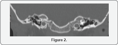 Click here to view Large Figure 2