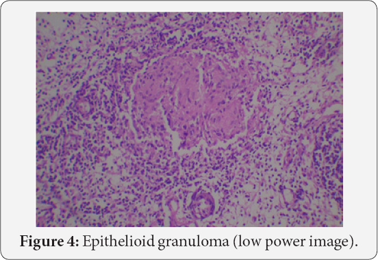 Click here to view Large Figure 4