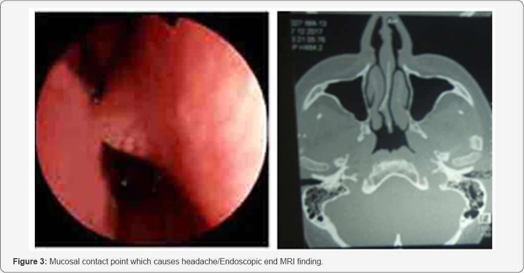 Click here to view Large Figure 3