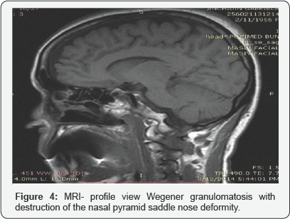Click here to view Large Figure 4